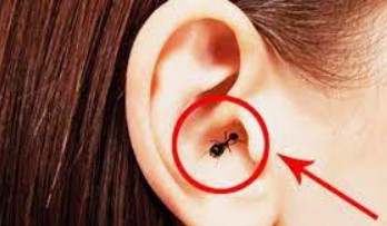 telinga kemasukan serangga