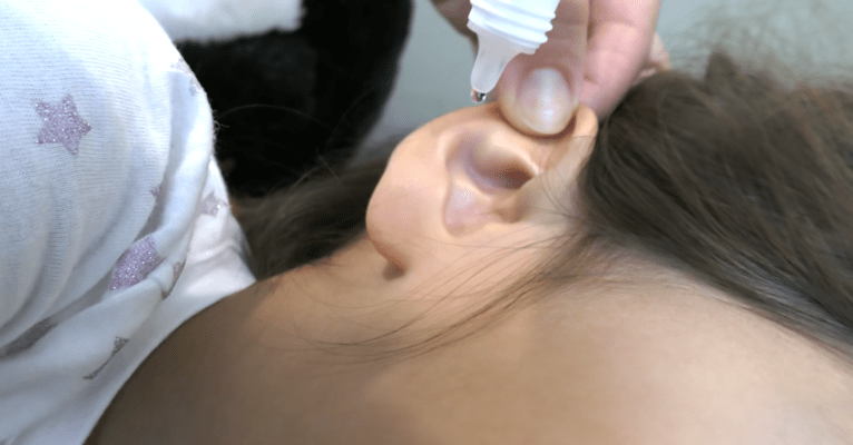 cara melarutkan kotoran telinga