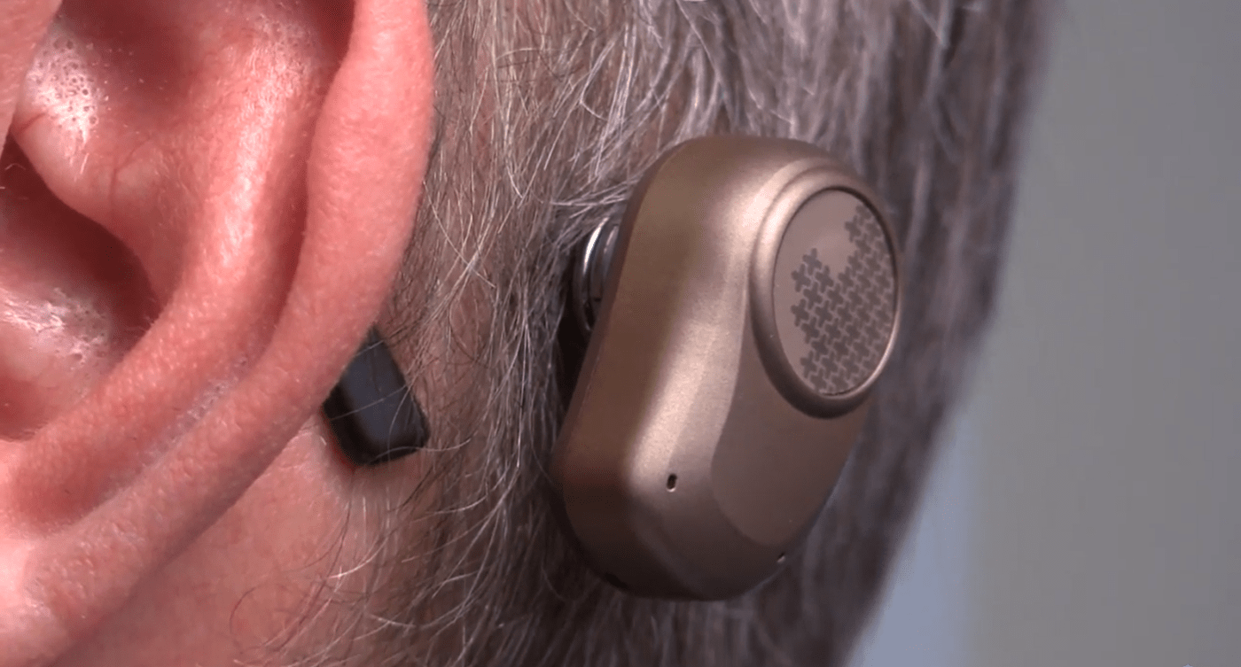 bone-anchored hearing system